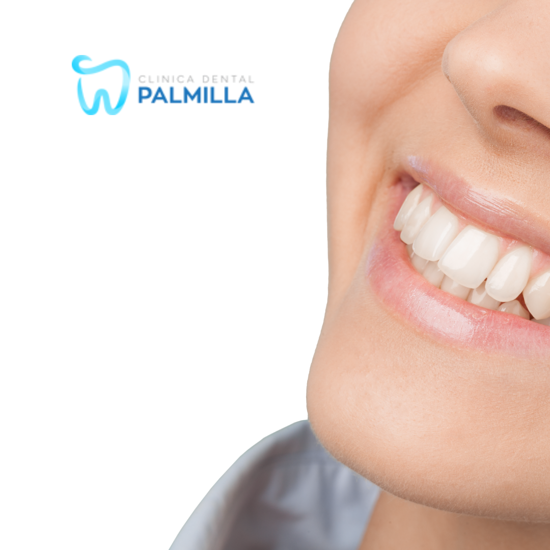 dentista en Almería. Una boca sonriente tras un tratamiento dental en una clínica dental de Almería